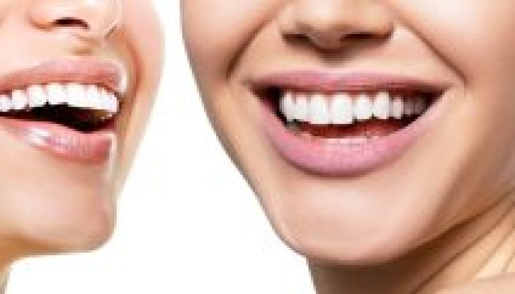 Can Invisalign Widen Your Smile?