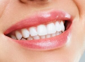 Teeth Whitening Manchester